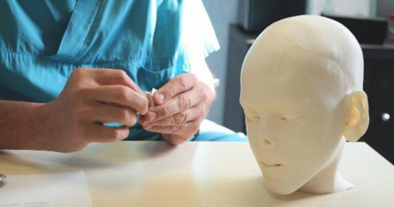 Naso di un bimbo aggredito da un animale ricostruito con stampe 3D. Il video